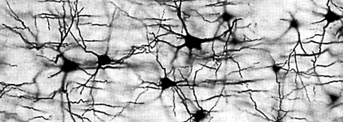 005-a-05-brain-neurons.gif