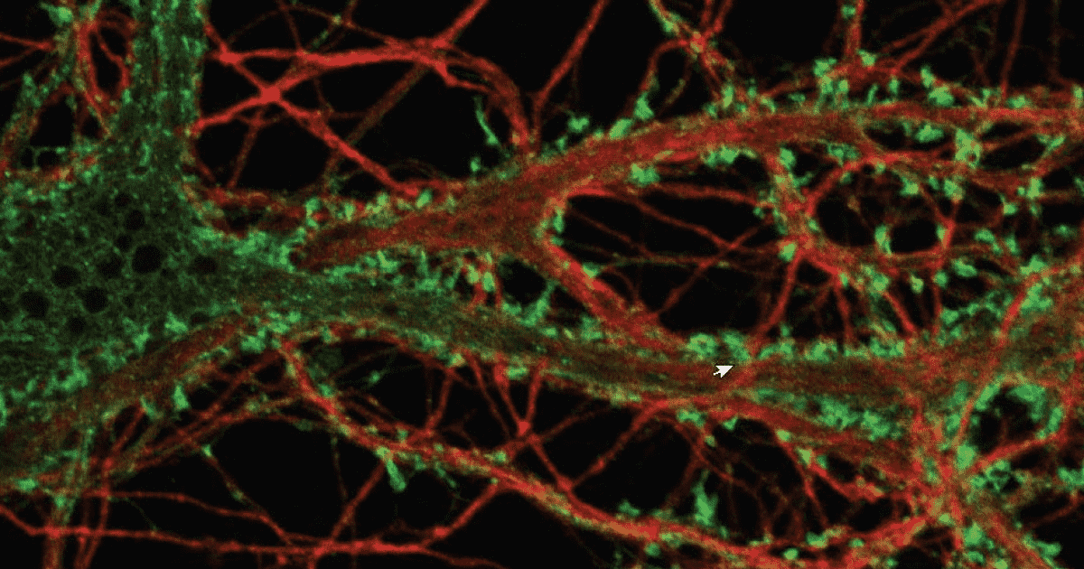 006-a-06-dopaminergic-neurons-3.png