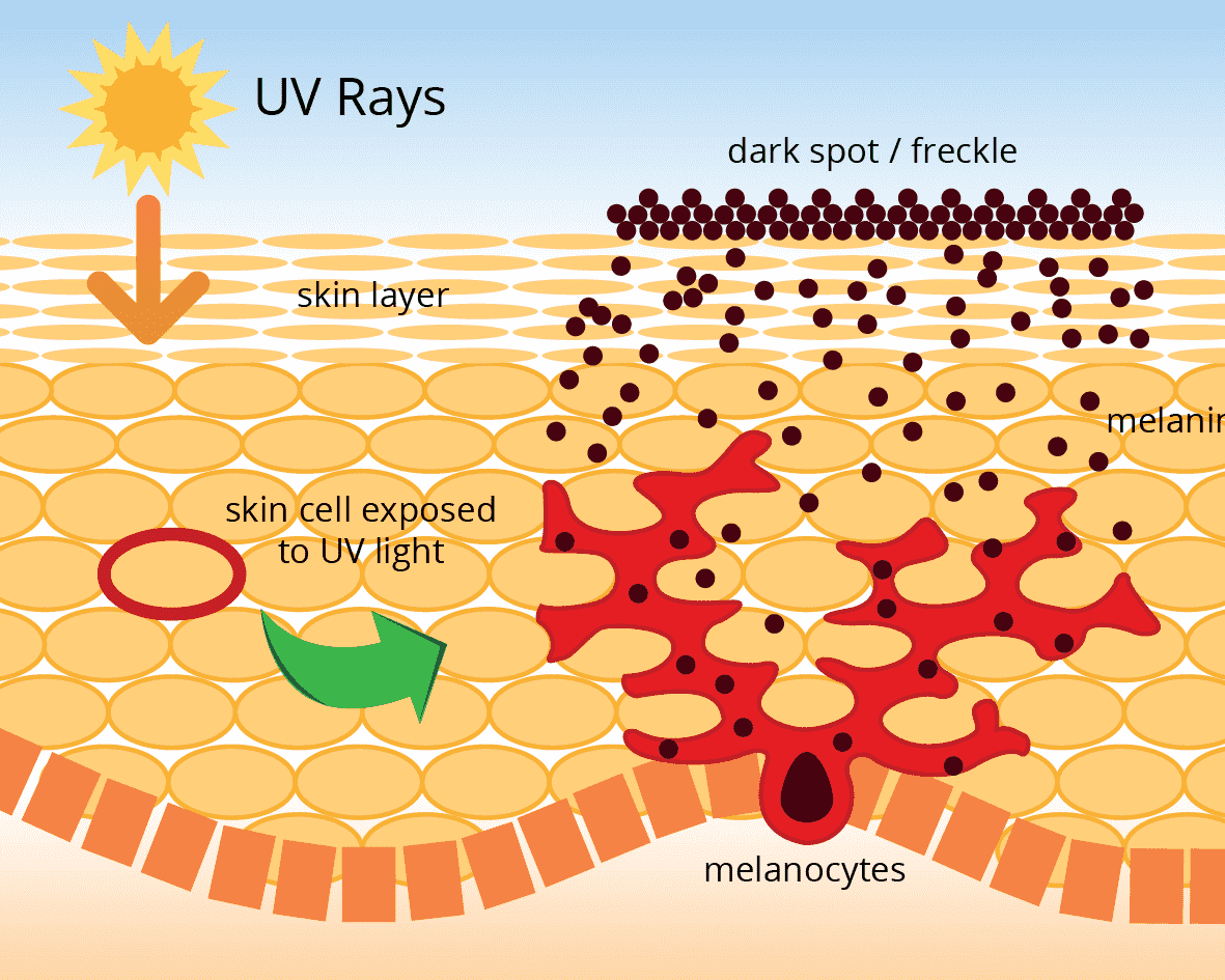 025-b-15-uv-rays-melanin.png