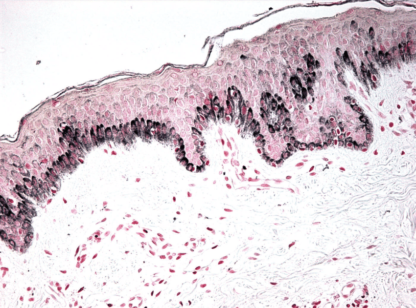 036-c-06-melanin-granules-4.png